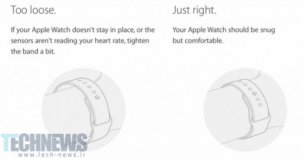 آیا ساعت هوشمند هوشمند اپل باعث مشکلات پوستی می‌شود؟