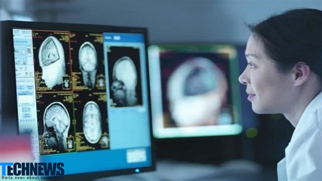 نقشه برداری از مغز تکنیکی مفید و کاربردی جهت تشخیص بیماریهای مغزی