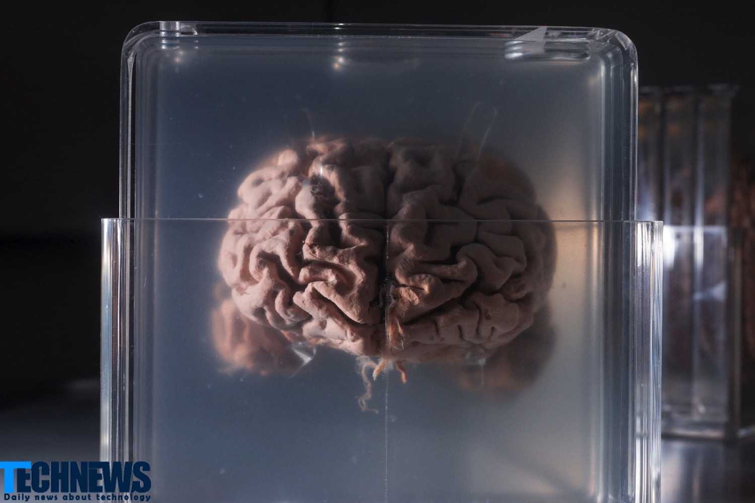 روش های درمانی جدید برای درمان سرطان مغز
