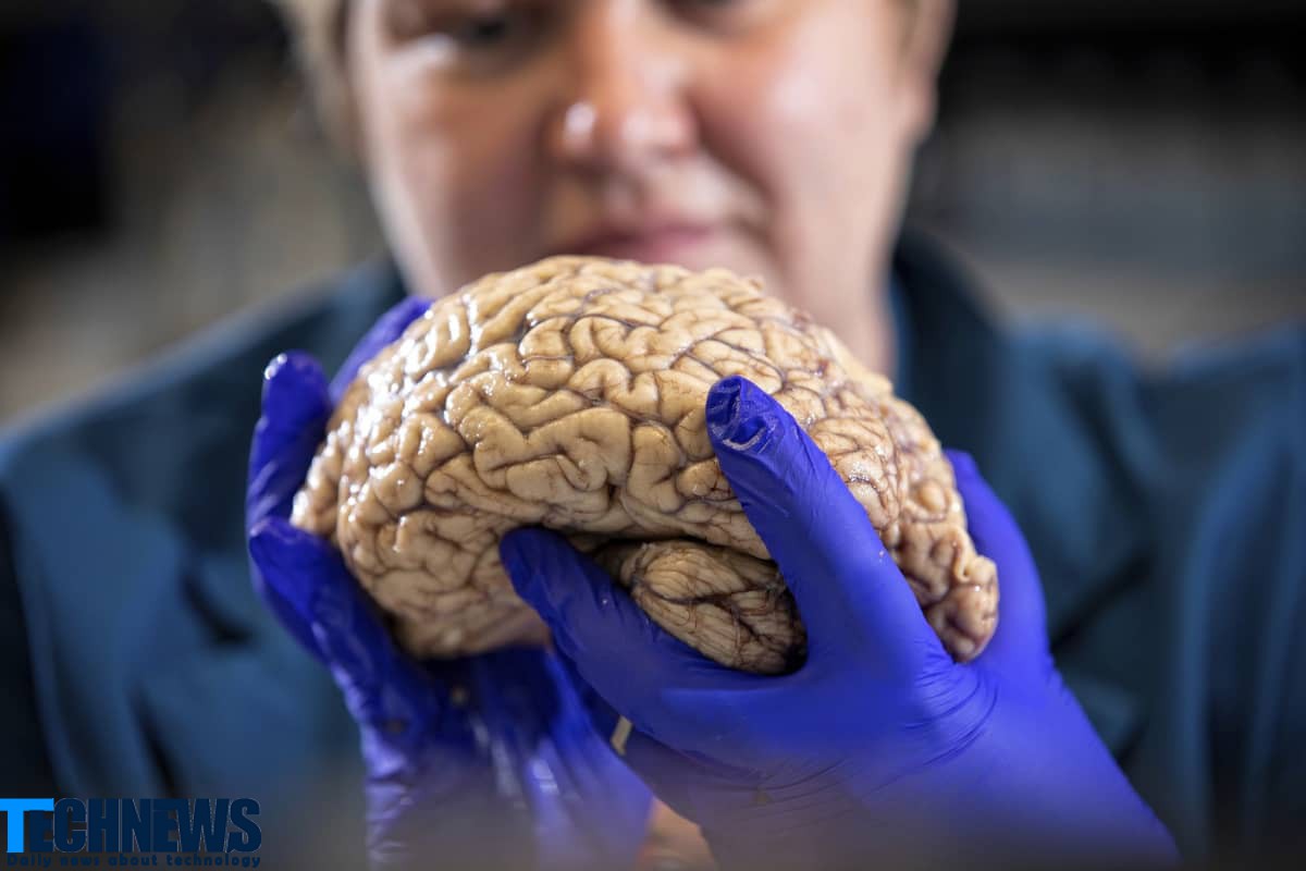دانشمندان عامل اصلی آلزایمر را نشت نوعی پروتئین در مغز می‌دانند