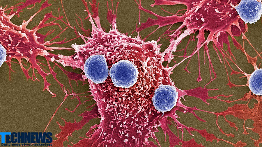 باکتری هایی که میتوانند ازطریق فراصوت منفجر شده و سلول‌های سرطانی را از بین ببرند