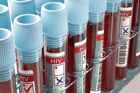 درمان موفقیت آمیز زن مبتلا به اچ آی وی با سلول های بنیادی