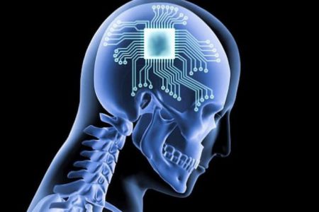 شرکت سینکرون رقیب نورالینک آزمایش انسانی ایمپلنت مغزی خود را آغاز کرد