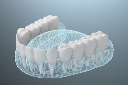 ابداع ماده جدید بر پایه ابریشم برای استفاده در ایمپلنت دندانی