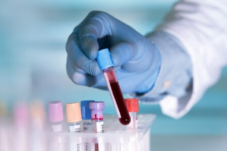 محققان روش جدیدی برای شناسایی ۱۴ نوع سرطان از طریق آزمایش خون ابداع کردند