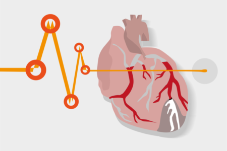 پیش بینی مرگ بیماران قلبی با کمک هوش مصنوعی