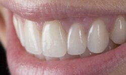 محققان ژاپنی رشد مجدد دندان ها در انسان را عملی می کنند