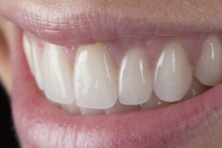 محققان ژاپنی رشد مجدد دندان ها در انسان را عملی می کنند