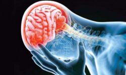 افراد حساس به گلوتن در صورت مصرف دچار التهاب مغز می‌شوند