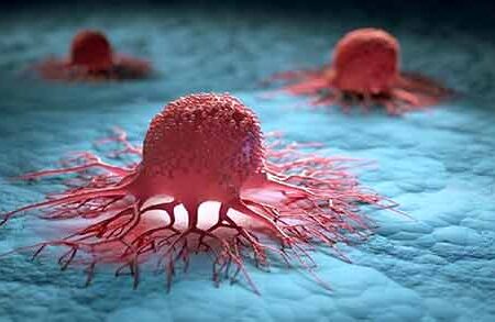 قرص جدید شیمی درمانی تومور های سرطانی را هدف قرار می دهد