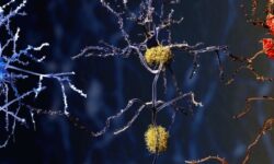 محققان با کالبد شکافی مغز مبتلایان به آلزایمر یافته‌های جدیدی را کشف کردند