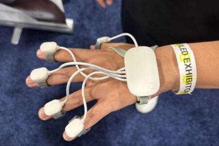 توسعه دستکش مخصوص بازی برای ردیابی بهبودی مبتلایان به سکته مغزی