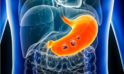 پیشرفت چشمگیر در تشخیص زودهنگام سرطان معده با استفاده از هوش مصنوعی