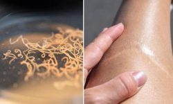 پروتئین کرم‌ها؛ امید جدید با توانایی شگفت‌انگیز در تسریع روند بهبودی زخم