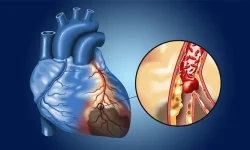 هوش مصنوعی ECG از روش‌های معمول در تیراژ روی‌گرفت رگ قلب پیشی می‌گیرد