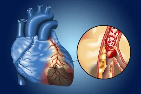 هوش مصنوعی ECG از روشهای معمول در تیراژ رویگرفت رگ قلب پیشی میگیرد