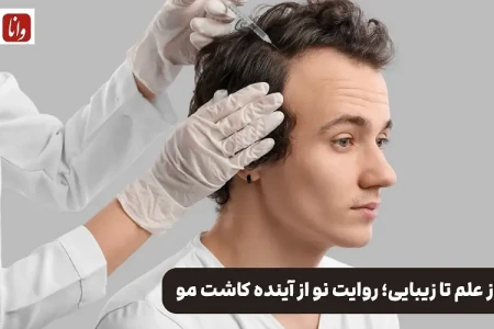 از علم تا زیبایی؛ روایت نو از آینده کاشت مو